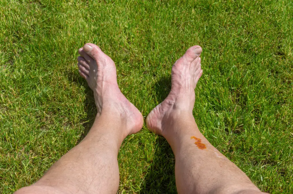 A senior flexes is feet on grass.